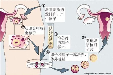 万级层流胚胎实验室